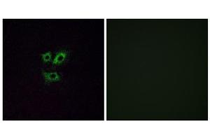 Immunofluorescence analysis of A549 cells, using OR2Y1 antibody. (OR2Y1 抗体  (Internal Region))