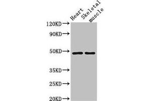 Western Blot Positive WB detected in: Mouse heart tissue, Mouse skeletal muscle tissue All lanes: CD36 antibody at 2 μg/mL Secondary Goat polyclonal to rabbit IgG at 1/50000 dilution Predicted band size: 54, 33, 49, 47 kDa Observed band size: 49 kDa (CD36 抗体  (AA 191-376))