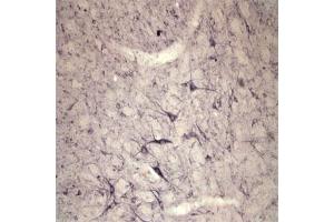 IHC on rat spinal cord using Rabbit antibody to extracellular, N-terminal part of Sortilin (Neurotensin receptor 3, NTR3, Sort1): IgG  at a concentration of 10 µg/ml. (Sortilin 1 抗体)