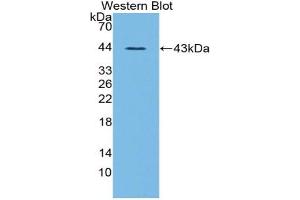 Western blot analysis of the recombinant protein. (Ghrelin 抗体  (AA 28-117))