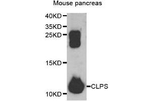 Western blot analysis of extracts of mouse pancreas, using CLPS antibody. (CLPS 抗体)