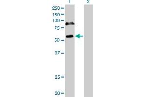 Western Blot analysis of RBM6 expression in transfected 293T cell line by RBM6 monoclonal antibody (M16), clone 4B3. (RBM6 抗体  (AA 1024-1123))
