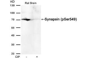 Western blot analysis of extracts from Rat brain tissue or calf intestinal phosphatase (CIP), using Synapsin (phospho-Ser549) Antibody. (SYN1 抗体  (pSer549))