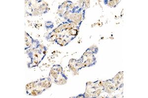 Immunohistochemistry of paraffin-embedded Human placenta using IGF1 antibody (ABIN1682184, ABIN3015345, ABIN3015346 and ABIN7101347) at dilution of 1:100 (40x lens). (IGF1 抗体)