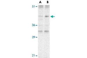 Western blot analysis of CARD8 expression in K-562 cell lysate with CARD8 polyclonal antibody  at (A) 2 and (B) 4 ug /mL . (CARD8 抗体  (C-Term))