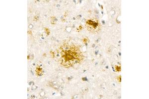 Immunohistochemistry analysis of paraffin embedded mouse Alzheimer',s brain using Aβ40 (ABIN7073042) at dilution of 1:1000 (Abeta 1-40 抗体)
