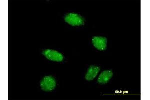 Immunofluorescence of monoclonal antibody to PIAS2 on HeLa cell. (PIAS2 抗体  (AA 385-473))