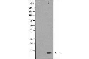 Western blot analysis of extracts of THP-1 , using CSTA antibody. (CSTA 抗体  (C-Term))