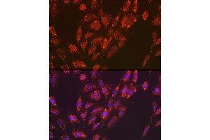 Immunofluorescence (IF) image for anti-Versican (Vcan) antibody (ABIN7271309)