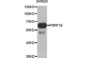 Western blot analysis of extracts of SW620 cells, using PRPF19 antibody (ABIN5974049) at 1/1000 dilution. (PRP19 抗体)