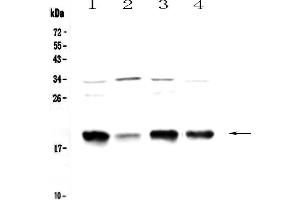 Western blot analysis of Galanin using anti-Galanin antibody .
