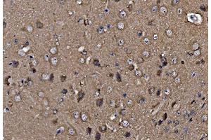 IHC analysis of Profilin 2/PFN2 using anti-Profilin 2/PFN2 antibody (ABIN7602692).