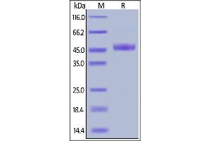 SDS-PAGE (SDS) image for Poliovirus Receptor-Related Immunoglobulin Domain Containing (PVRIG) (AA 41-171) (Active) protein (Fc Tag) (ABIN6809885)