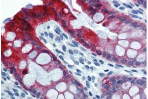 Colon, Human: Formalin-Fixed, Paraffin-Embedded (FFPE) (Cytokeratin 18 抗体)