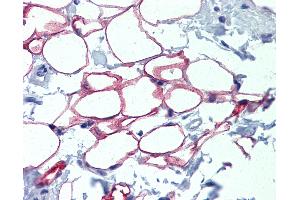 Immunohistochemistry (IHC) image for anti-Nuclear Factor I/C (CCAAT-Binding Transcription Factor) (NFIC) (AA 323-372) antibody (ABIN6744464)