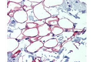 Anti-NFIC antibody IHC of normal human adrenal (adipocytes). (NFIC 抗体  (AA 323-372))