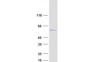 Western Blotting (WB) image for Glycerol Kinase (GK) (Transcript Variant 1) protein (Myc-DYKDDDDK Tag) (ABIN2722033)