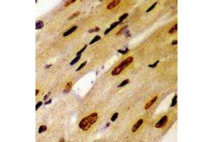 Immunohistochemical analysis of PSMC2 staining in mouse heart formalin fixed paraffin embedded tissue section. (PSMC2 抗体)
