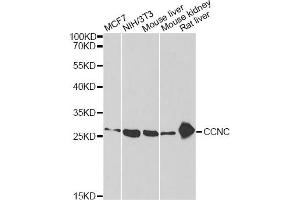Western blot analysis of extracts of various cell lines, using CCNC antibody (ABIN2561645) at 1:1000 dilution. (Cyclin C 抗体)