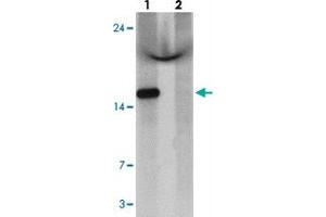 Western blot analysis of C1orf64 in HeLa cell lysate with C1orf64 polyclonal antibody  at 1 ug/mL in (lane 1) the absence and (lane 2) the presence of blocking peptide. (C1orf64 抗体  (C-Term))