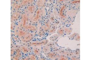 IHC-P analysis of kidney tissue, with DAB staining. (COL3A1 抗体  (AA 1171-1435))