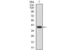 Fig. (SLUG 抗体  (AA 100-200))