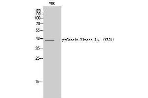 Western Blotting (WB) image for anti-Casein Kinase 1, alpha 1 (CSNK1A1) (pTyr321) antibody (ABIN3182288) (CSNK1A1 抗体  (pTyr321))