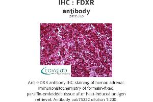 Image no. 2 for anti-Ferredoxin Reductase (FDXR) antibody (ABIN1734312) (Ferredoxin Reductase 抗体)