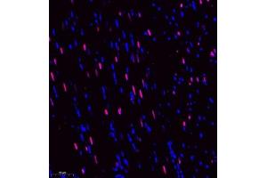 Immunofluorescence of paraffin embedded rat heart using DEPDC1 (ABIN7073717) at dilution of 1:500 (250x lens) (DEPDC1 抗体)