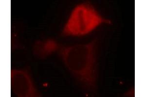 Immunofluorescence staining of methanol-fixed Hela cells using MKK3(Phospho-Ser189) Antibody. (MAP2K3 抗体  (pSer189))