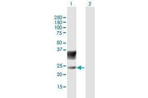 Western Blotting (WB) image for anti-Sodium Channel, Voltage-Gated, Type III, beta Subunit (SCN3B) (AA 1-215) antibody (ABIN1329530)