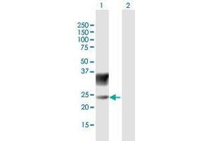 Western Blot analysis of SCN3B expression in transfected 293T cell line by SCN3B MaxPab polyclonal antibody. (SCN3B 抗体  (AA 1-215))