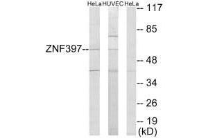 Western blot analysis of extracts from HeLa cells and HUVEC cells, using ZNF397 antibody. (ZNF397 抗体  (N-Term))