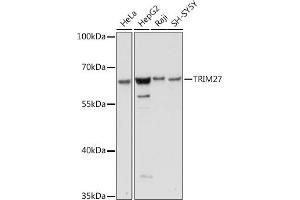 Western blot analysis of extracts of various cell lines, using TRIM27 antibody (ABIN7269922) at 1:1000 dilution. (TRIM27 抗体  (AA 1-200))