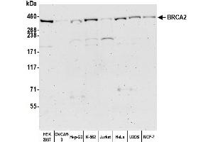 anti-Breast Cancer 2, Early Onset (BRCA2) (C-Term) antibody