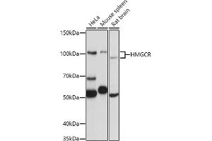 Western blot analysis of extracts of various cell lines, using HMGCR antibody (ABIN6132111, ABIN6141869, ABIN6141870 and ABIN6217262) at 1:1000 dilution. (HMGCR 抗体  (AA 629-888))