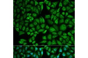 Immunofluorescence analysis of MCF-7 cells using CTSA Polyclonal Antibody (CTSA 抗体)
