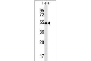 SCHIP1 Antibody (Center) (ABIN656782 and ABIN2846000) western blot analysis in Hela cell line lysates (35 μg/lane). (SCHIP1 抗体  (AA 90-118))
