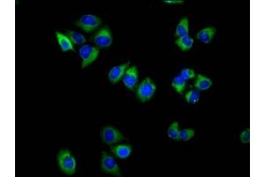 Immunofluorescence staining of Hela cells with ABIN7171862 at 1:100, counter-stained with DAPI. (Tetraspanin 18 抗体  (AA 151-223))