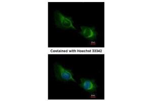 ICC/IF Image Immunofluorescence analysis of methanol-fixed HeLa, using Deltex1, antibody at 1:200 dilution. (Deltex Homolog 1 抗体  (Center))