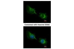 ICC/IF Image Immunofluorescence analysis of methanol-fixed HeLa, using Deltex1, antibody at 1:200 dilution. (Deltex Homolog 1 抗体  (Center))