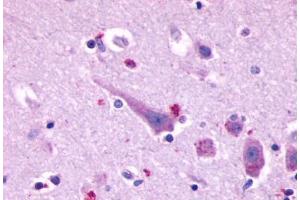 Anti-PROKR2 antibody  ABIN1049245 IHC staining of human brain, neurons and glia. (Prokineticin Receptor 2 抗体  (C-Term))