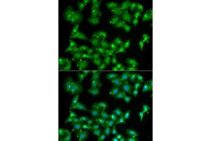 Immunofluorescence analysis of A549 cells using ELF3 antibody (ABIN5973778). (ELF3 抗体)