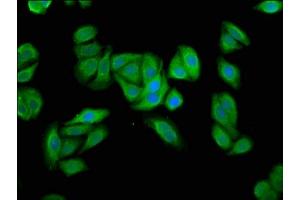 Immunofluorescence staining of HepG2 cells with ABIN7174220 at 1:66, counter-stained with DAPI. (UBIAD1 抗体  (AA 1-82))