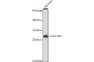 Western blot analysis of extracts of Rat brain, using Calbindin antibody (ABIN7266004) at 1:1000 dilution. (CALB1 抗体  (AA 1-261))