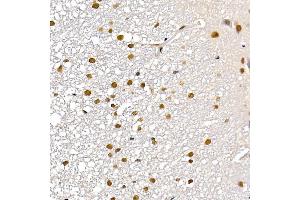 Immunohistochemistry of paraffin-embedded rat kidney using TES Rabbit pAb (ABIN7270772) at dilution of 1:200 (40x lens). (TES 抗体  (AA 1-260))