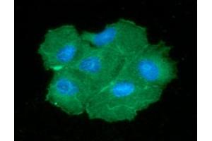 ICC/IF analysis of PGAM2 in Hep3B cells line, stained with DAPI (Blue) for nucleus staining and monoclonal anti-human PGAM2 antibody (1:100) with goat anti-mouse IgG-Alexa fluor 488 conjugate (Green). (PGAM2 抗体  (AA 1-253))