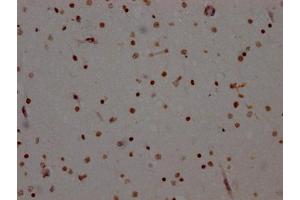 IHC image of ABIN7127324 diluted at 1:100 and staining in paraffin-embedded human brain tissue performed on a Leica BondTM system. (Recombinant ADAR 抗体)
