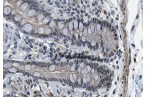 ABIN6266680 at 1/100 staining human colon tissue sections by IHC-P. (ANO9 抗体  (Internal Region))