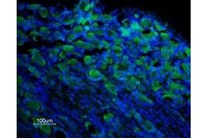 Immunohistochemistry (IHC) image for anti-Transient Receptor Potential Cation Channel, Subfamily M, Member 8 (TRPM8) (AA 917-929), (Extracellular) antibody (ABIN7043837)
